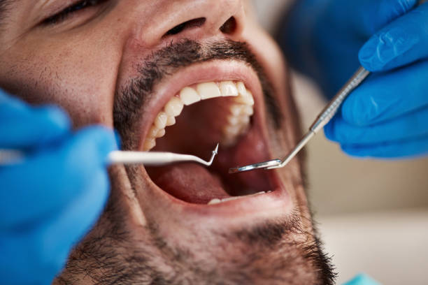 Best Emergency Dental Care for Abscessed Tooth in Ethete, WY